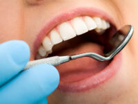 Best Practices for Healthy Teeth